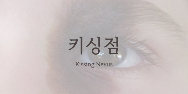 선천성 멜라닌세포성모반, 키싱점 Kissing Nevus