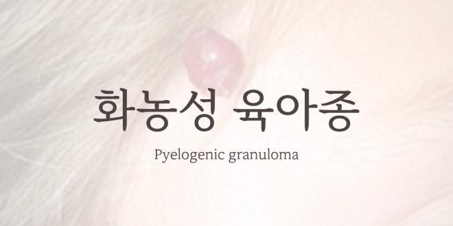 화농성 육아종 Pyogenic Granuloma