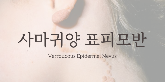 사마귀양 표피모반 Verroucous Epidermal Nevus